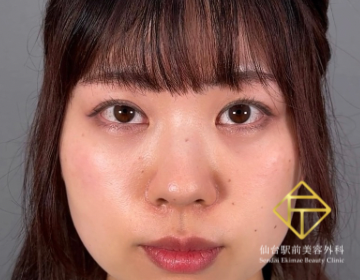 After