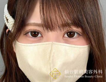 After