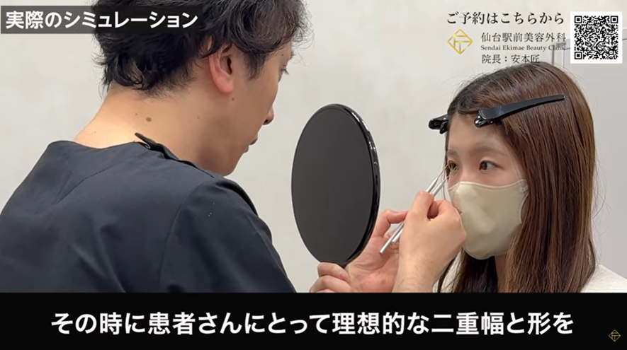 重瞼棒を使用した二重のシミュレーション