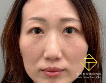 After