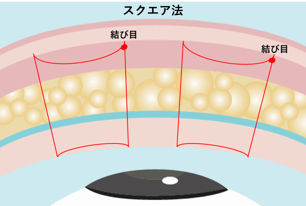 スクエア法の図