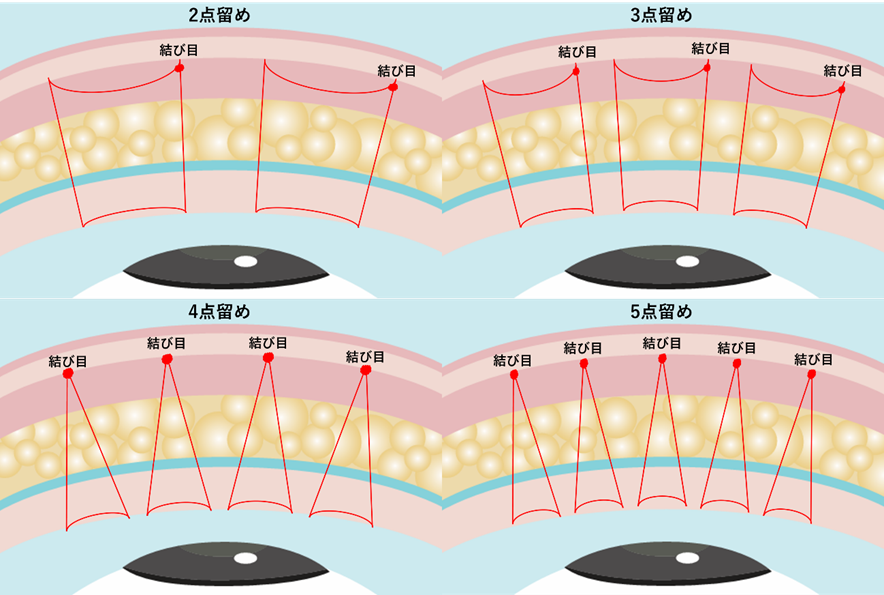 留める点数による1点当たりのスペースの違い