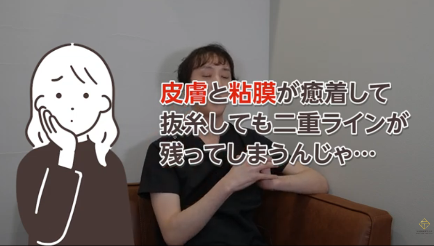 埋没法後は、早くしないと癒着してラインが元に戻らないという嘘