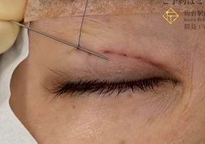 結び目の位置を決める