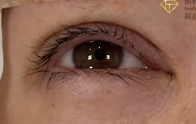 仕上がりの確認