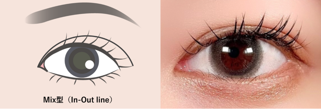 Mix型(ミックス型)二重、In-Out-line(インアウトライン)とも呼ばれる