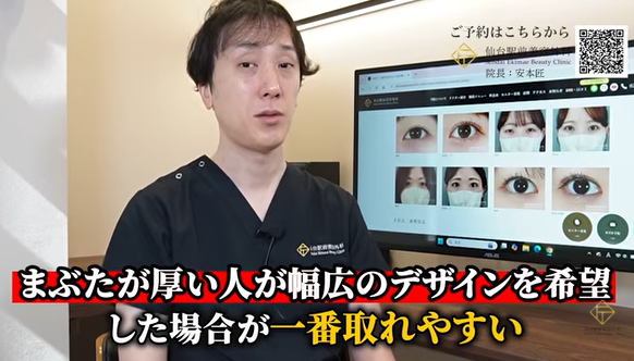 まぶたが厚い人は埋没が取れやすい