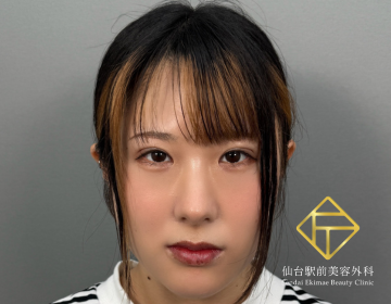 After