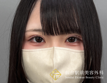 After