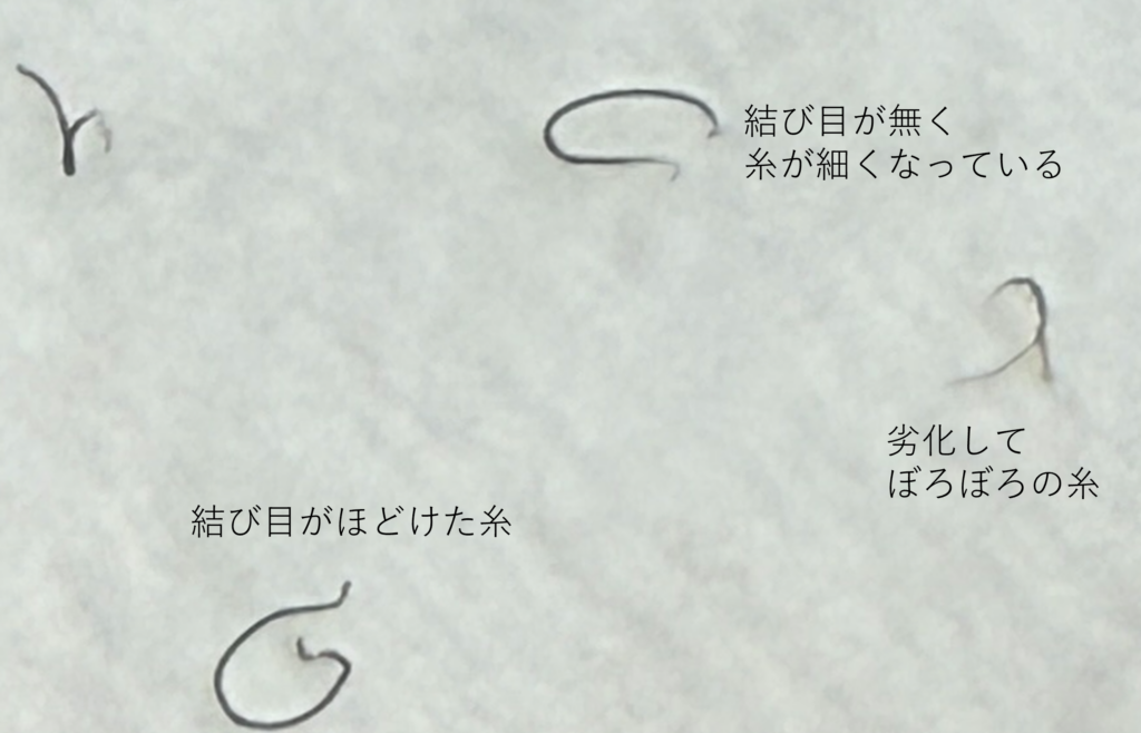 二重埋没法から数年が経過し、結び目がほどけたり、溶けたり、劣化したナイロン糸