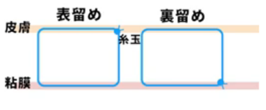 表留めと裏留めの違い